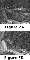 Figure 7A-7B.