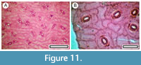 s figure11